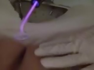 Locekļa un olu mocīšana electro mokas fisting klīnika medicīnas studenti: bezmaksas hd x nominālā filma 86